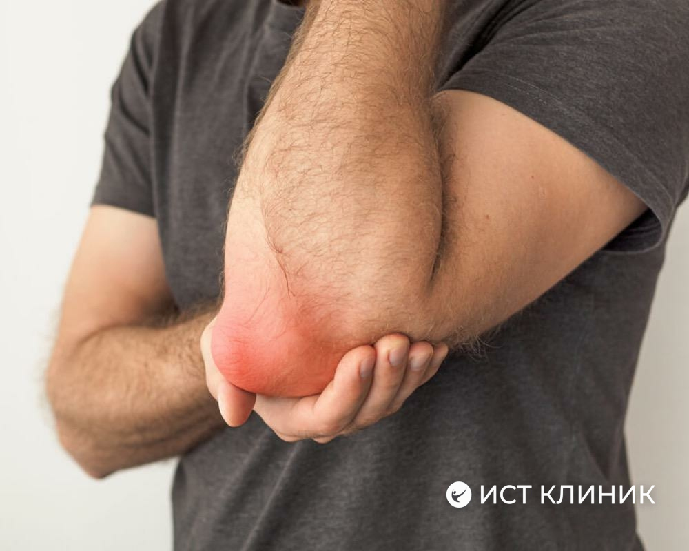 Лечение локтевого бурсита в Ист Клиник, Москва